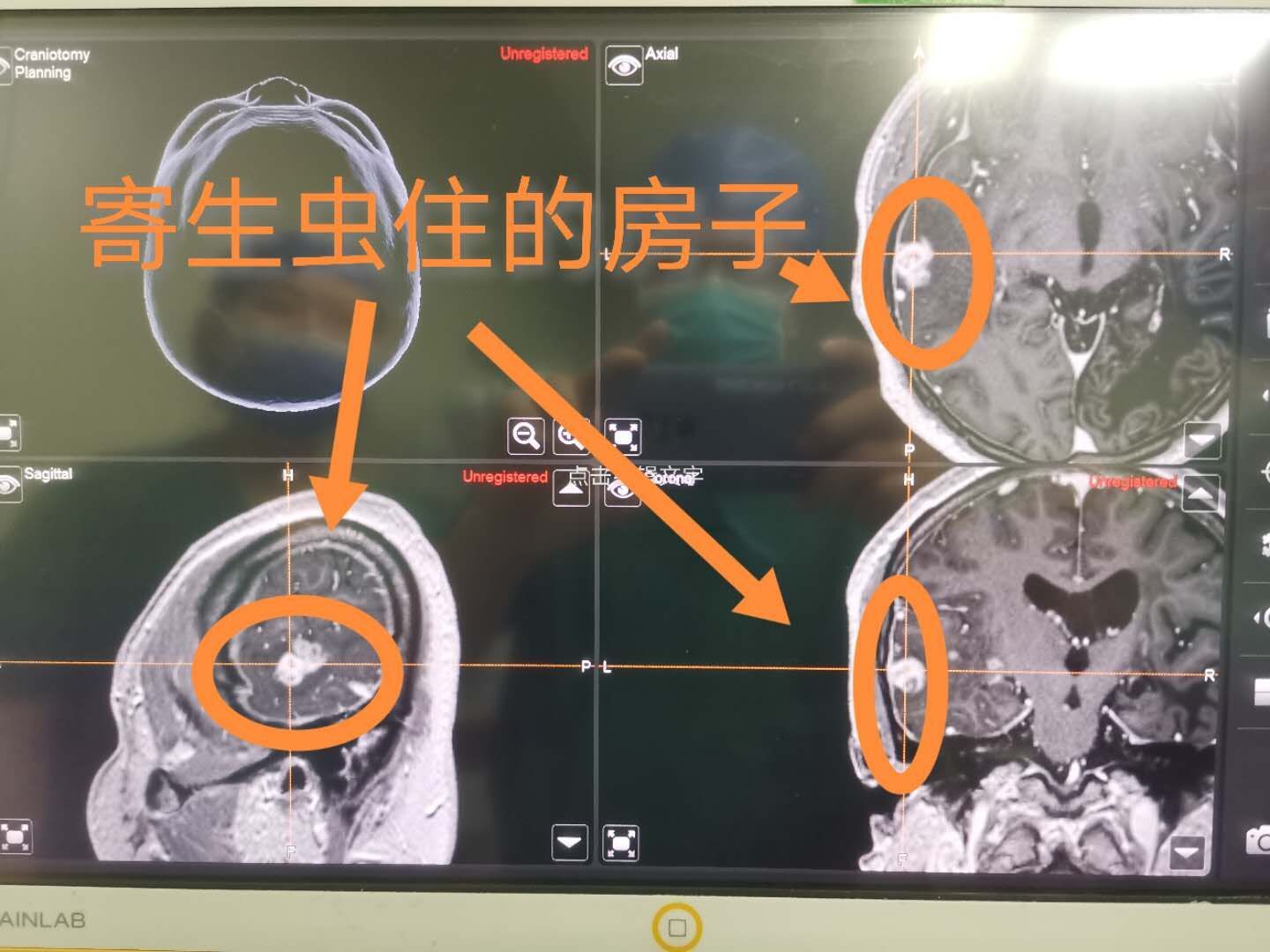 寄生虫app_体内寄生虫下载_寄生虫下载地址