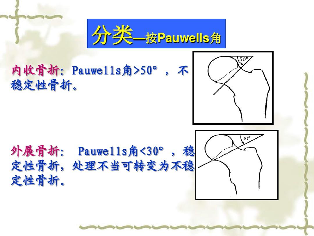 的游戏手机支架_手机游戏支架推荐_游戏专用手机支架