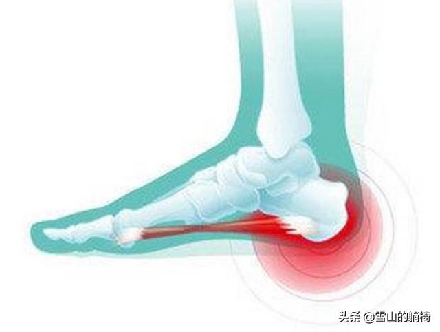 打完手机游戏脚疼怎么办_打完手机游戏脚疼怎么办_打完手机游戏脚疼怎么办