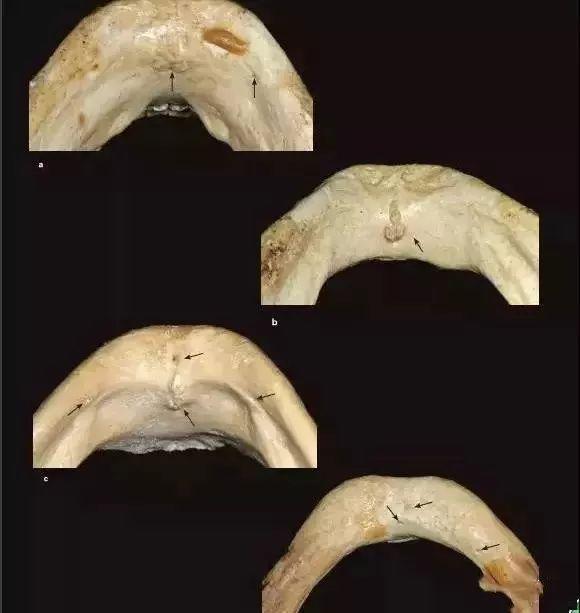 叔牙与伯牙_叔牙是什么意思_牙叔