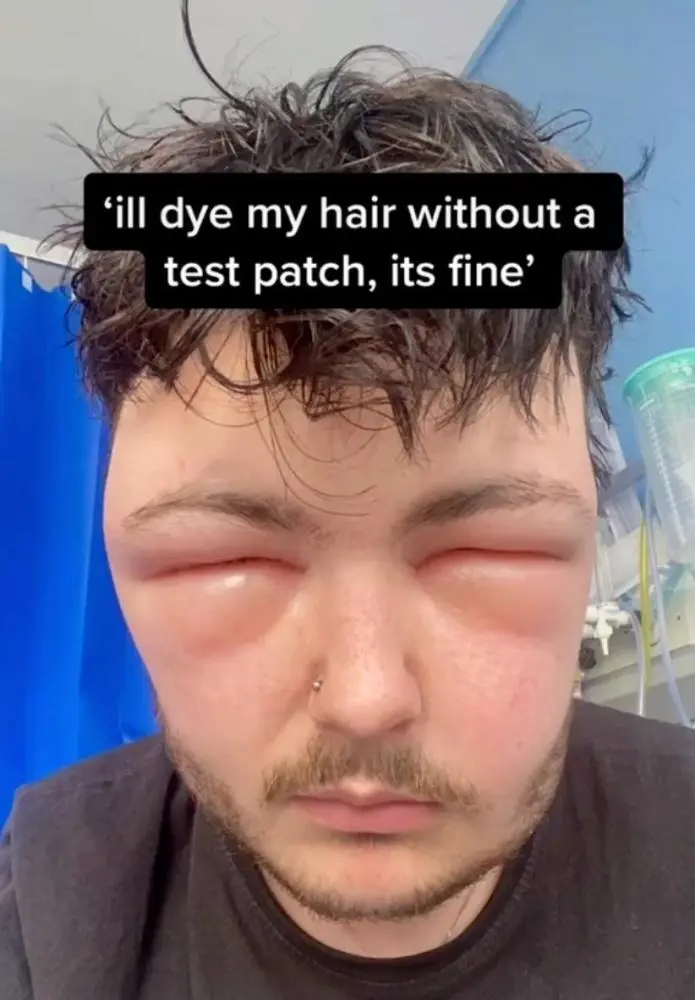 手机游戏对视力的影响_视力沉迷手机游戏会怎么样_沉迷手机游戏会什么视力
