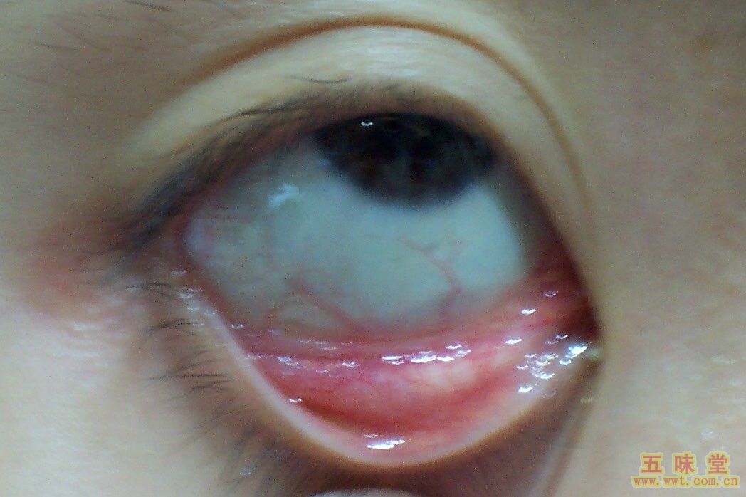 虎拳_阿五变身铁拳虎_拳虎武器