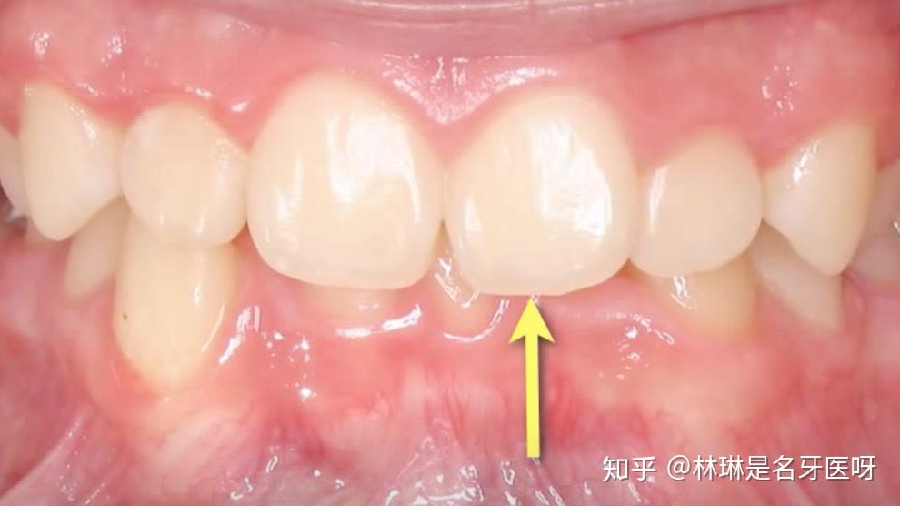 玩游戏损耗手机吗_玩大型手机游戏对手机损耗_多玩游戏会损耗手机吗知乎