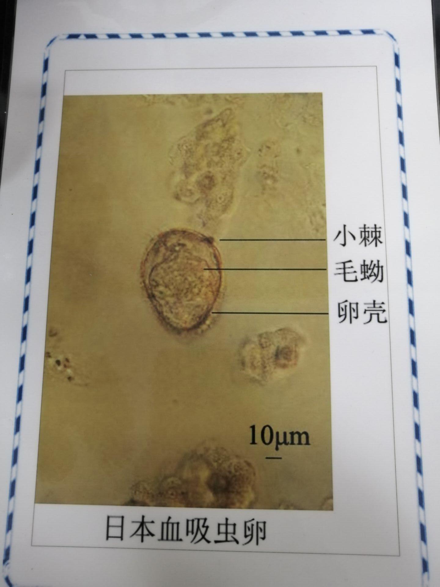 盘吸虫图片_双盘吸虫_盘吸虫寄生蜗牛