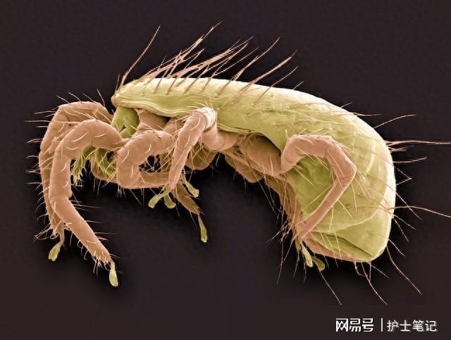 盘吸虫图片_盘吸虫寄生蜗牛_双盘吸虫