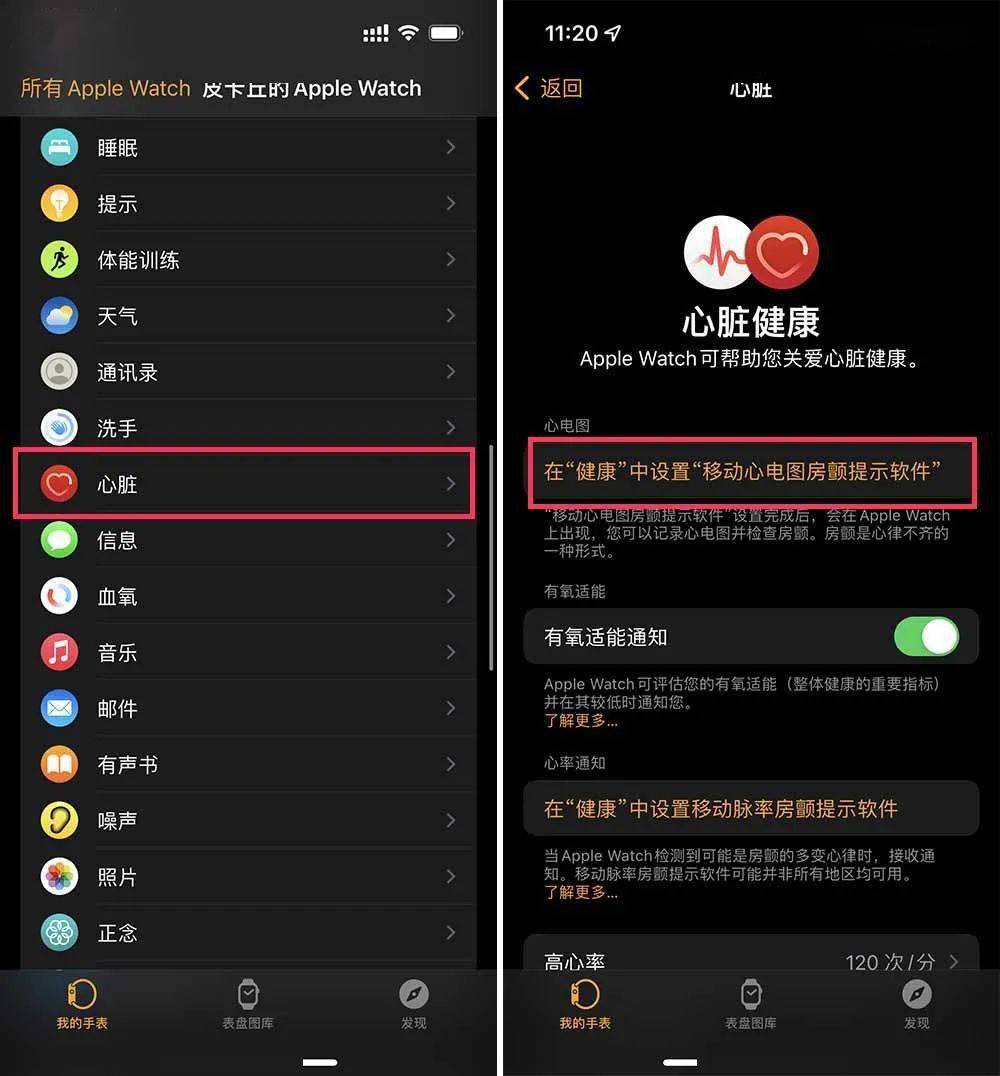 iwatch开启心电图的条件_千万不要开启iwatch心电图_watch打开心电图